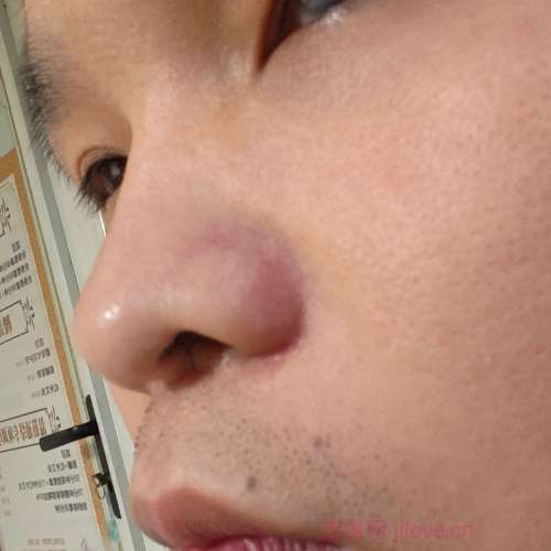 30岁岁江苏单身帅哥 - 池州吉缘网